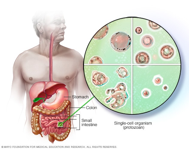 Blastocystis hominis
