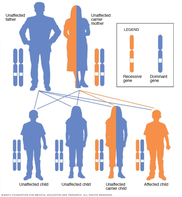 X-chromosomal-rezessives Vererbungsmuster mit Trägermutter