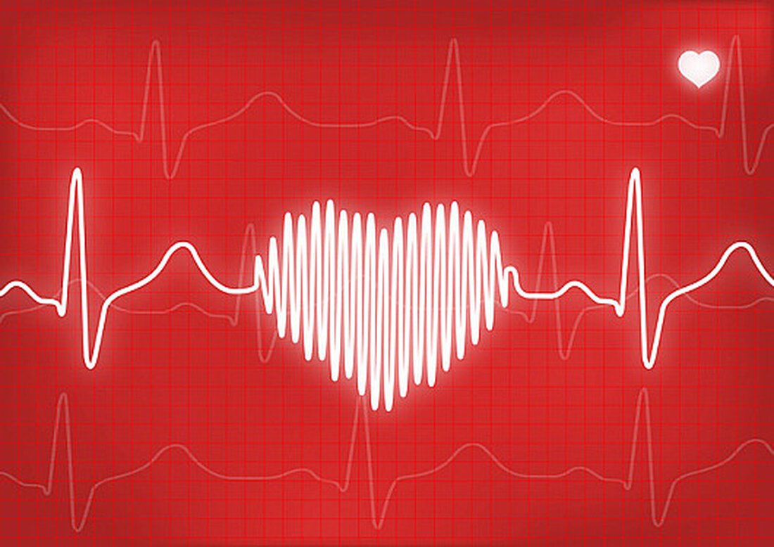 Liebe ist nicht der einzige Grund, warum Ihr Herz einen Schlag aussetzen kann. Während anormale Herzschläge alarmierend sein können, sind sie normalerweise harmlos. Sie treten aus unterschiedlichen Gründen auf. Welche Arten sind üblich – und wann sollten Sie sich Sorgen machen? Herzklopfen Ihr Herzschlag behält normalerweise ein vorhersehbares Tempo bei: Er beschleunigt sich, wenn Sie aktiv sind, und verlangsamt sich, wenn Sie sich ausruhen. Aber viele Menschen bemerken mindestens hin und wieder seltsame Herzempfindungen, die als Herzklopfen bezeichnet werden. Die Leute sagen normalerweise, dass es sich anfühlt, als ob ihr Herz einen Schlag ausgesetzt hat oder rast oder pocht. „Ein …