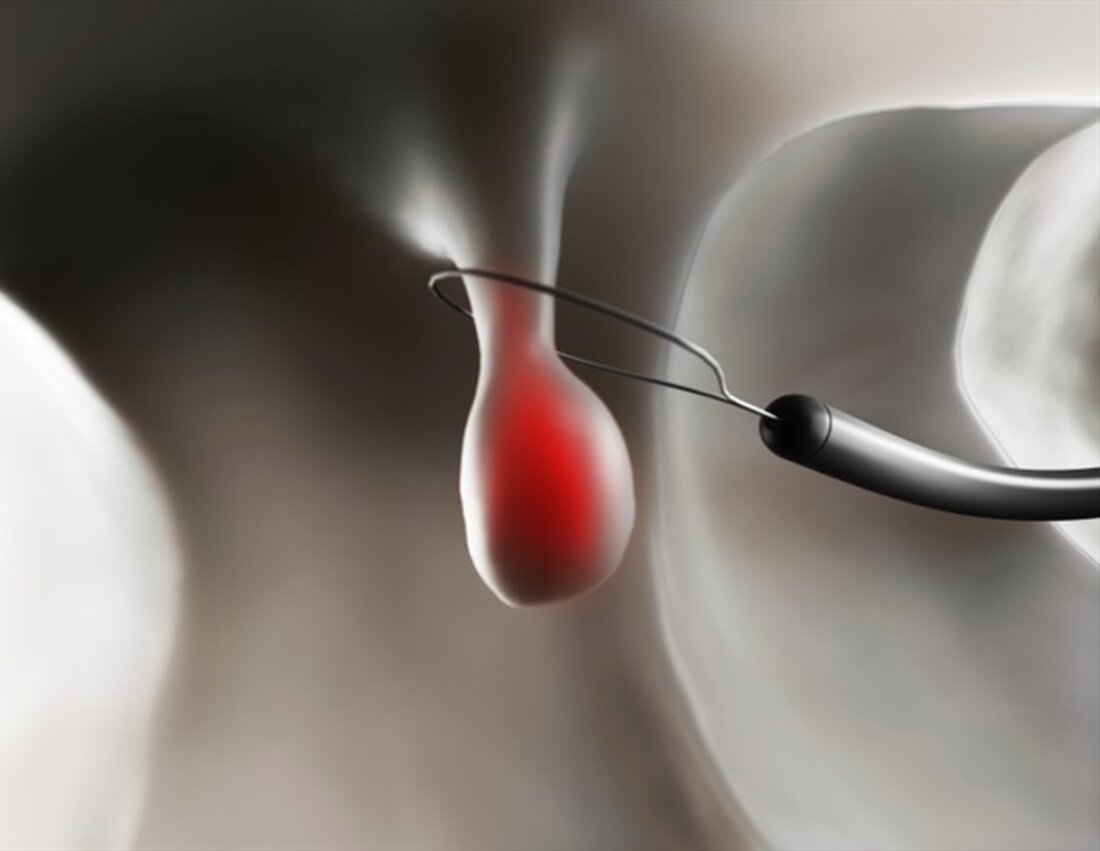 Staatsangestellte in Colorado werden aufgefordert, beim Einkauf von Gesundheitsdiensten bessere Verbraucher zu sein. Und wenn sie sich für kostengünstigere und qualitativ hochwertigere Anbieter entscheiden, könnten sie per Post einen Scheck für einen Teil der Einsparungen erhalten. Es ist Teil einer Initiative namens Colorado Purchasing Alliance, durch die sich Arbeitgeber im Bundesstaat zusammenschließen, um niedrigere Preise für Gesundheitsdienste auszuhandeln. Die Landesregierung ist einer von 12 Arbeitgebern, die sich dem Bündnis angeschlossen haben und als erster die neu ausgehandelten Tarife und Verbraucherförderungen nutzen werden. Das Ziel ist es, den als dysfunktional geltenden Markt für Gesundheitsversorgung zu stören, indem Arbeitgeber und Arbeitnehmer ermutigt …