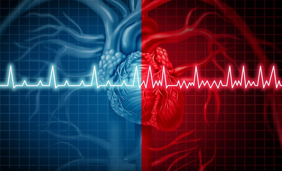 Eine kürzlich veröffentlichte Studie in der Zeitschrift des American College of Cardiology fanden heraus, dass ein genomweiter polygener Score für koronare Herzkrankheit (GPSCAD) das Risiko eines plötzlichen und/oder arrhythmischen Todes (SAD) bei Patienten mit koronarer Herzkrankheit (KHK) ohne schwere systolische Dysfunktion vorhersagen kann. Daher kann dieser Bewertungsscore helfen, die Indikationen für einen implantierbaren Kardioverter-Defibrillator (ICD) bei dieser Patientengruppe zu bestimmen. Ursprüngliche Untersuchung: Polygenic Risk Score sagt plötzlichen Tod bei Patienten mit Koronarerkrankung und erhaltener systolischer Funktion voraus. Bildnachweis: Lightspring/Shutterstock Hintergrund Forscher haben zahlreiche Studien durchgeführt, um Risikopatienten für Herz-Kreislauf-Erkrankungen zu identifizieren und sie wirksam zu behandeln. In letzter Zeit wurde …