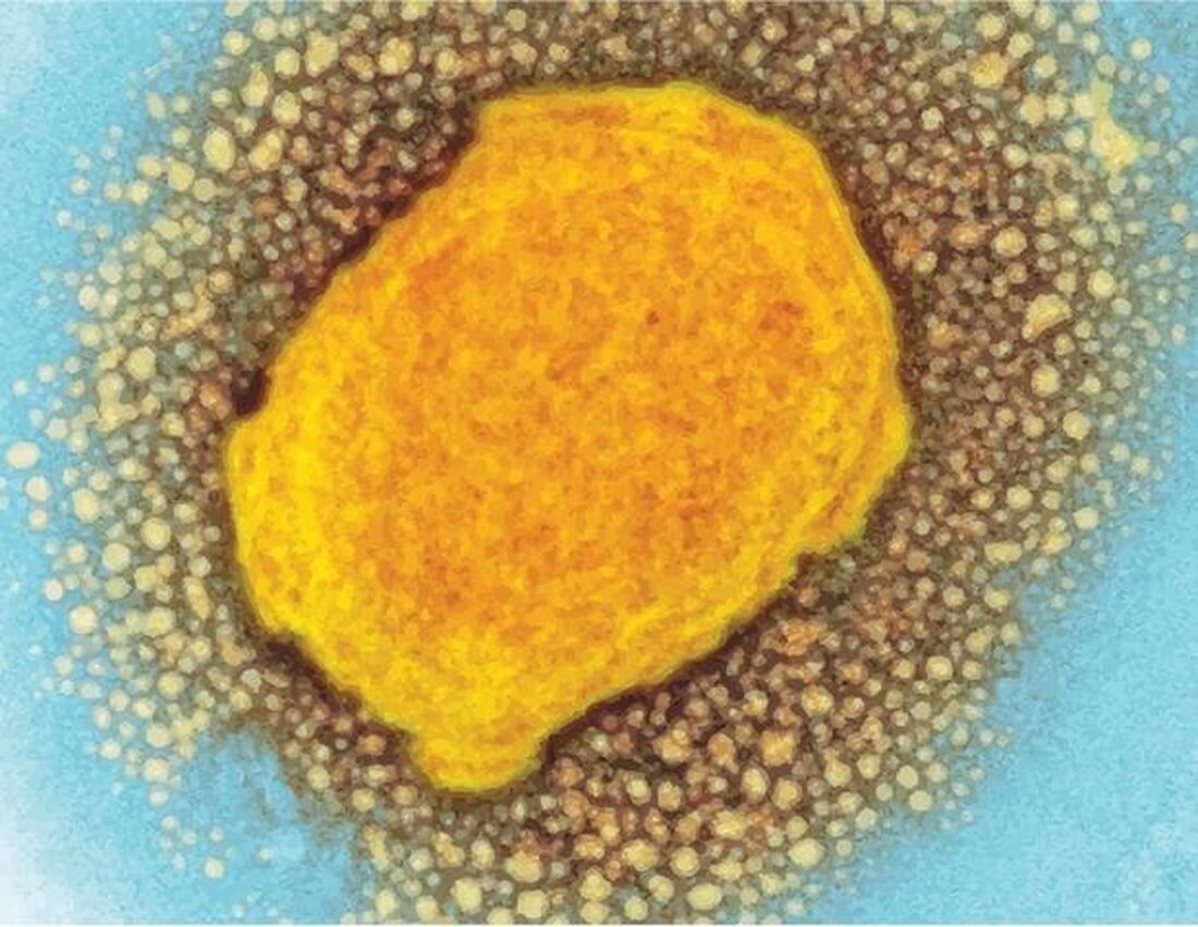 In der Demokratischen Republik Kongo (DRK) hat eine klinische Studie zur Bewertung des antiviralen Medikaments Tecovirimat, auch bekannt als TPOXX, bei Erwachsenen und Kindern mit Affenpocken begonnen. In der Studie werden die Sicherheit des Medikaments und seine Fähigkeit bewertet, die Symptome von Affenpocken zu lindern und schwerwiegende Folgen, einschließlich des Todes, zu verhindern. Das National Institute of Allergy and Infectious Diseases (NIAID), Teil der US National Institutes of Health, und das National Institute for Biomedical Research (INRB) der Demokratischen Republik Kongo leiten die Studie gemeinsam im Rahmen der PALM-Partnerschaft zwischen Regierungen. Zu den kooperierenden Institutionen gehören die US-amerikanischen Centers for …