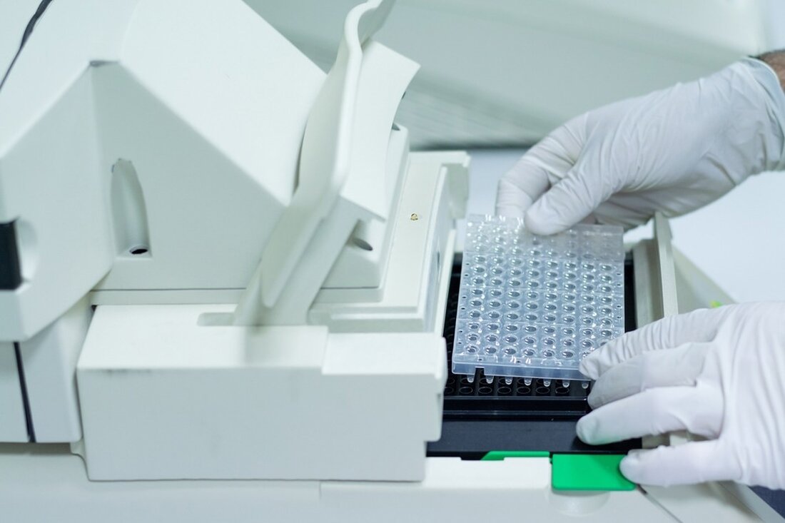 In einer kürzlich veröffentlichten Studie medRxiv*, Forscher validierten Affenpockenvirus (MPXV) quantitative Polymerase-Kettenreaktion (qPCR)-Assays. Lernen: Bewertung und klinische Validierung von Affenpockenvirus-Echtzeit-PCR-Assays. Bildnachweis: Oscar Martinez Troncoso/Shutterstock Hintergrund Fälle von Affenpocken beim Menschen (MPX) wurden seit ihrer Entdeckung in den 1970er Jahren selten außerhalb von MPXV-endemischen Ländern entdeckt. Diese zoonotische Krankheit wurde trotz Warnungen vor einer weltweiten Ausbreitung und der Hinweise auf eine zunehmende Übertragung von Mensch zu Mensch bis zum anhaltenden Ausbruch vernachlässigt. Im Rahmen des anhaltenden MPX-Ausbruchs wurden mehr als 77.000 MPX-Fälle aus über 100 Ländern gemeldet. MPX-Fälle können mit Fieber, Lymphadenopathie und einem papillären Ausschlag einhergehen. Bei immungeschwächten Personen besteht &hellip;