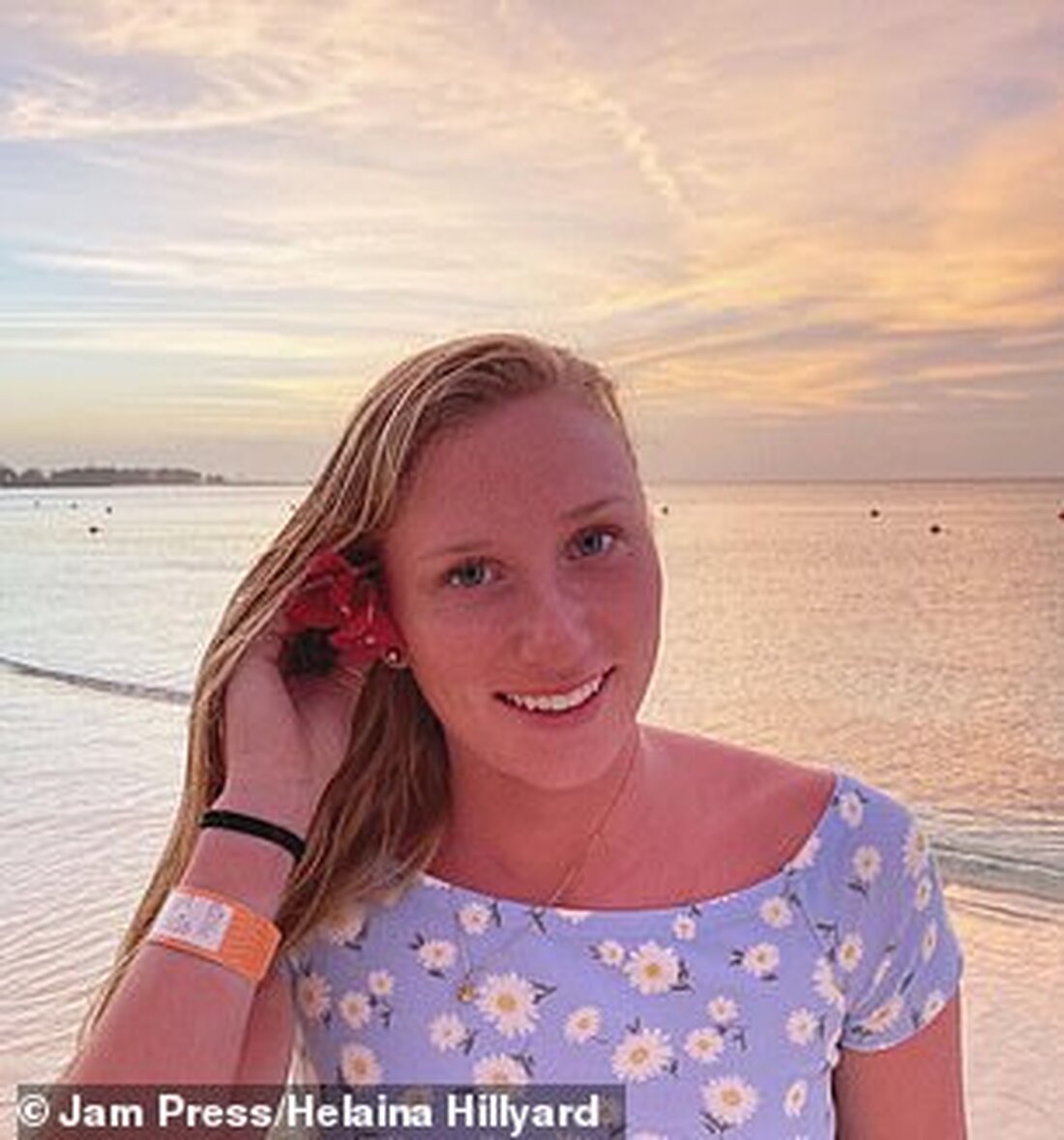 Helaina Hillyard, 20, aus Mediapolis, Iowa, fand heraus, dass die Flecken, die sich an ihrem Arm und Bein entwickelten, tatsächlich ein Zeichen für einen seltenen Blutkrebs waren Sie hielt zunächst nicht viel von den Flecken, wurde aber von ihrer Schwester gedrängt, sie untersuchen zu lassen Nachdem sie in eine Notaufnahme gegangen war und Bluttests durchgeführt hatte, erfuhr sie, dass sie an akuter lymphoblastischer Leukämie litt Sie ist guter Dinge, während sie sich der Behandlung unterzieht, und hofft, diesen Herbst wieder zur Schule gehen zu können Eine Frau aus Iowa war schockiert, als sie herausfand, dass kleine rote Punkte, die auf …