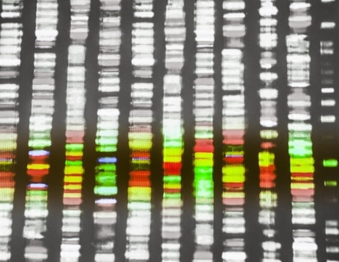 Ein als chromosomale Microarray-Analyse (CMA) bekannter Gentest könnte helfen, die Ursache des plötzlichen Kindstods (SIDS) oder seines Gegenstücks bei älteren Kindern, bekannt als plötzlicher unerklärlicher Tod in der Kindheit (SUDC), zu identifizieren, findet eine Studie unter der Leitung des Boston Children’s Hospital . Die Forscher unter der Leitung von Richard Goldstein, MD, Ingrid Holm, MD, MPH, und Catherine Brownstein, MPH, PhD, fordern, CMA bei der Untersuchung von SIDS und SUDC zur Routine zu machen. Sie veröffentlichten ihre Studienergebnisse online am 7. November in der Zeitschrift Advanced Genetics. „Wir glauben, dass wir genug Informationen haben, um zu sagen, dass CMA eine …