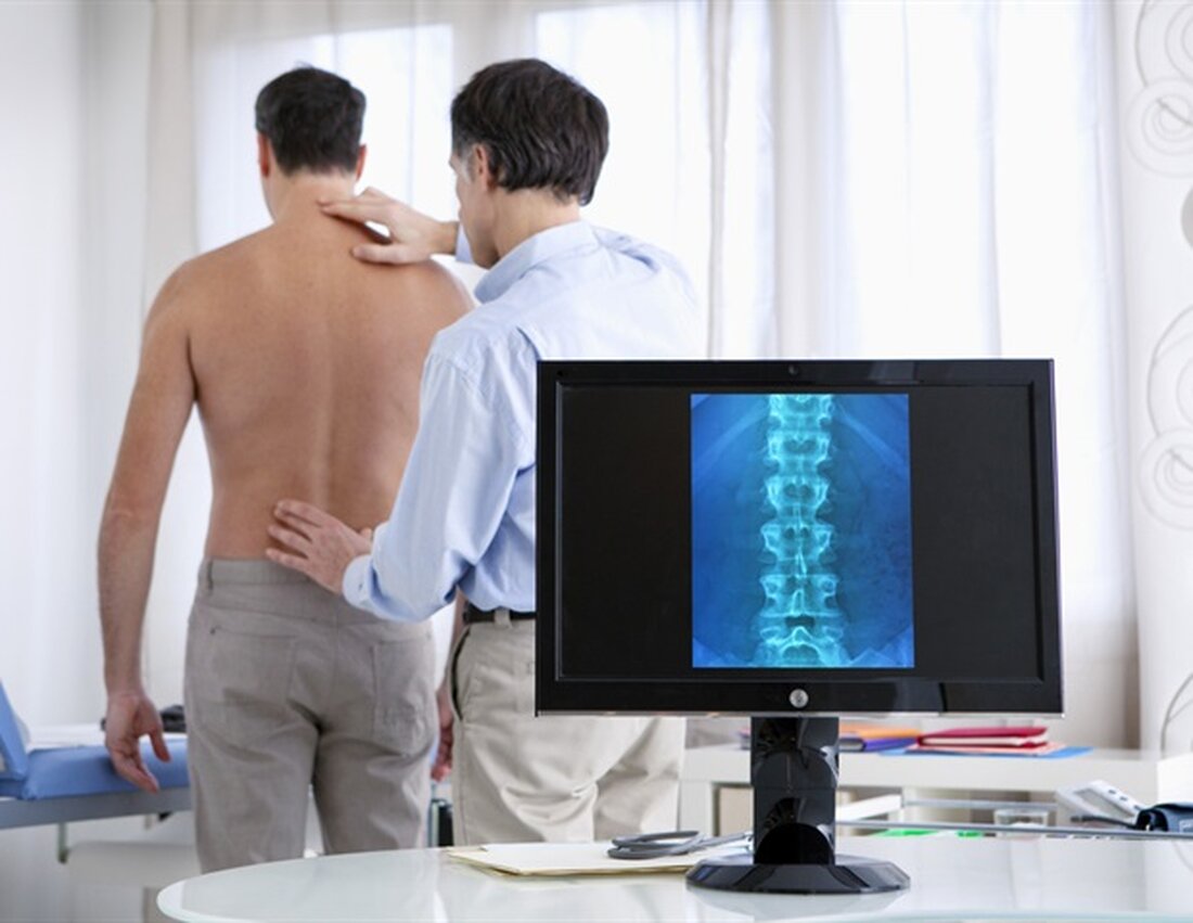 Typ-I-Interferon (IFN) ist ein starker Immunaktivator, der bei der Mehrzahl der Patienten mit Lupus, einer Autoimmunerkrankung, in hohen Konzentrationen vorhanden ist. In Arthritis & Rheumatology berichten Forscher über positive Ergebnisse der ersten placebokontrollierten Langzeitstudie mit Anifrolumab – einem humanen monoklonalen Antikörper, der auf den Typ-I-IFN-Rezeptor abzielt – bei Patienten mit Lupus. In der Langzeit-Verlängerungsstudie von zwei früheren Phase-3-Studien erhielten die Patienten weiterhin 300 mg Anifrolumab, wechselten von Anifrolumab 150 mg zu 300 mg oder wurden von Placebo erneut randomisiert entweder zu Anifrolumab 300 mg oder weiterhin mit Placebo, verabreicht alle 4 Wochen, wobei alle Patienten auch eine Standardtherapie erhalten. Anifrolumab …