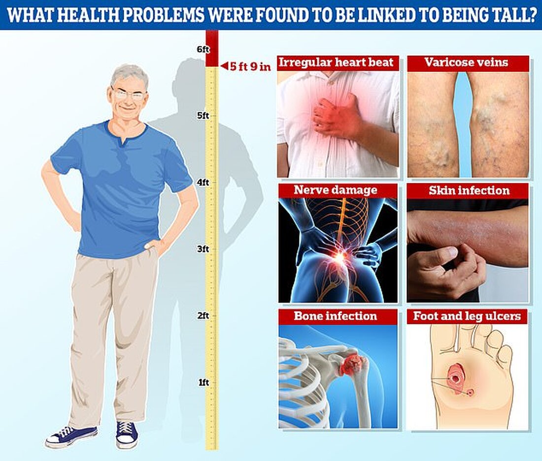 Eine genetische Studie mit 250.000 Erwachsenen ergab, dass 100 Erkrankungen mit der Körpergröße zusammenhängen Dazu gehörten unregelmäßiger Herzschlag, Krampfadern und Nervenerkrankungen Die durchschnittliche Größe in der US-Studie betrug 5 Fuß 9 Zoll, ähnlich der eines typischen Briten Laut der größten Studie dieser Art haben große Menschen ein höheres Risiko für mehr als 100 Gesundheitsprobleme. Die Forscher untersuchten mehr als 1.000 Erkrankungen bei 250.000 weißen, hispanischen und schwarzen Männern und Frauen in den USA. Sie fanden heraus, dass eine große Körpergröße mit einem höheren Risiko für Herzrhythmusstörungen, Krampfadern, Nervenschäden und Fußgeschwüren verbunden ist. Große Menschen – definiert als Personen ab einer …