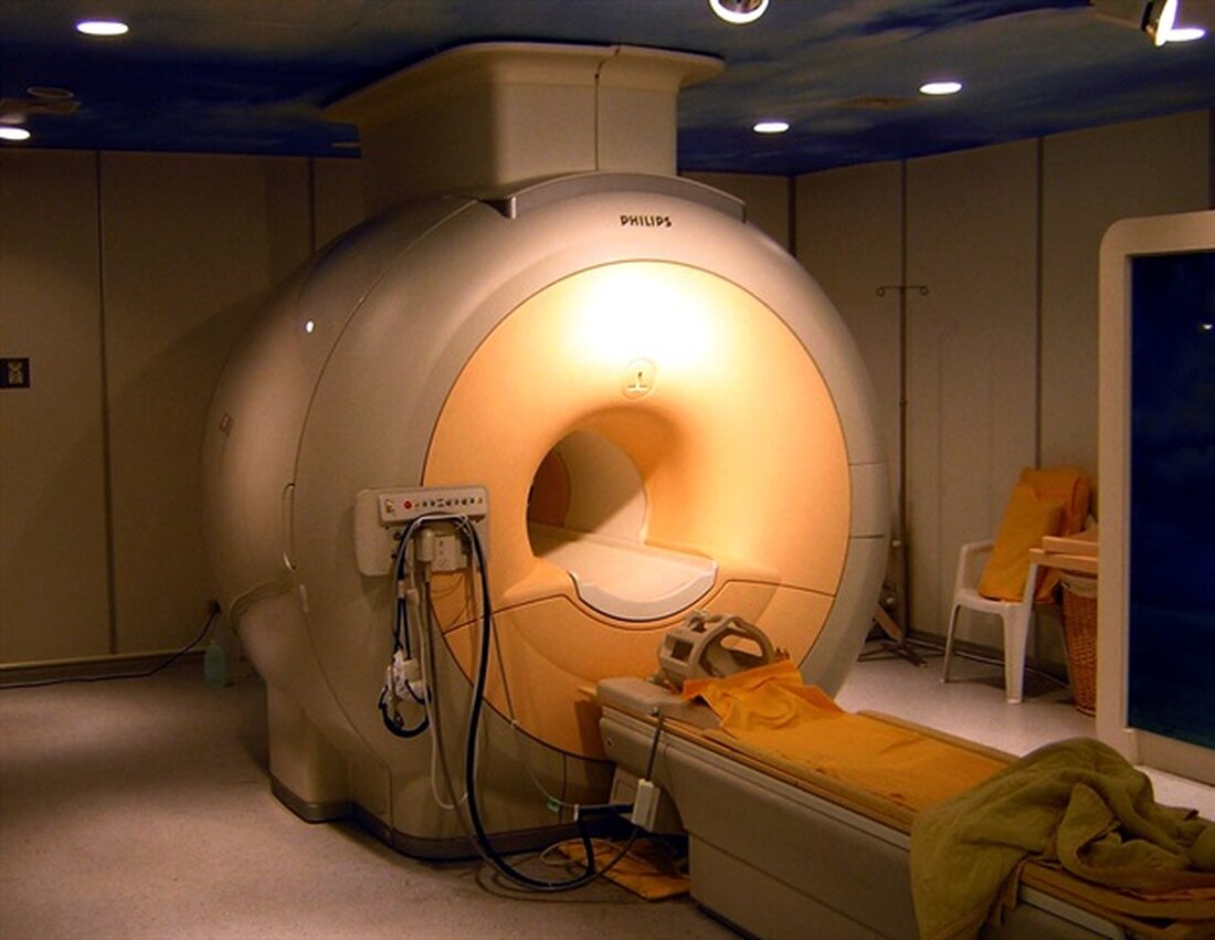 Magnetresonanztomographie (MRT) kann zuverlässig Messungen für „Fußabdrücke“ des vorderen Kreuzbandes (ACL) erstellen, die für die Platzierung von Transplantaten für Rekonstruktionsoperationen entscheidend sind, berichten Forscher von UT Southwestern. Jay P. Shah, MD, Assistenzprofessor in der Abteilung für orthopädische Chirurgie an der UTSW, und seine Kollegen verwendeten zwei- und dreidimensionale Magnetresonanztomographie (MRT), um diese Messungen zu bestimmen, ein Ansatz, der zuvor noch nicht erforscht worden war. Ihre Studie wurde in European Radiology veröffentlicht. Diese Studie beweist, dass 2D- und 3D-MRT bei der Bestimmung der Besonderheiten des ACL-Fußabdrucks zuverlässig sind.“ Dr. Jay P. Shah, MD, Assistenzprofessor, Abteilung für orthopädische Chirurgie, UTSW Das Kreuzband …