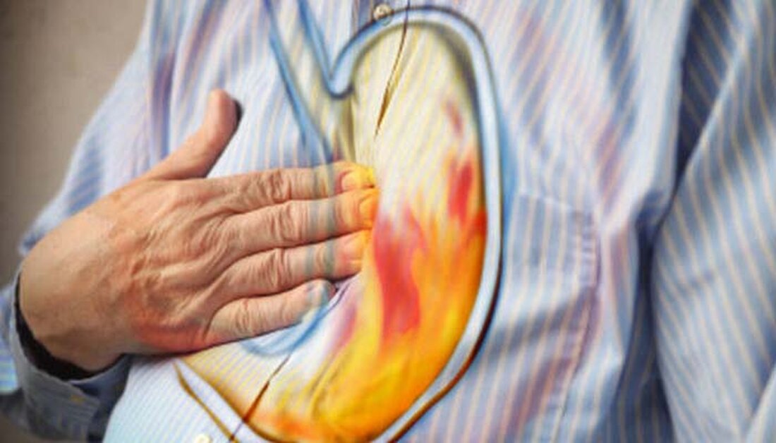 Ersticken kann für viele saure Refluxkranke, sowohl Säuglinge als auch Erwachsene, eine sehr verblüffende und beunruhigende Erfahrung sein. Das Symptom des Erstickens tritt normalerweise nachts auf, wenn eine Person schläft, und Ersticken weckt die Person, die dann normalerweise heftig hustet, um sich zu räuspern und zu Atem zu kommen. Warum kommt es zu saurem Rückfluss und Ersticken? Wenn während des Schlafes saurer Reflux auftritt, werden die natürlichen Abwehrkräfte des Körpers gegen Reflux deaktiviert. Zum Beispiel haben Sie nicht mehr die Fähigkeit, Speichel zu schlucken, der die Säure neutralisiert, und der untere Schließmuskel der Speiseröhre (LES) entspannt sich, sodass die Magensäure …