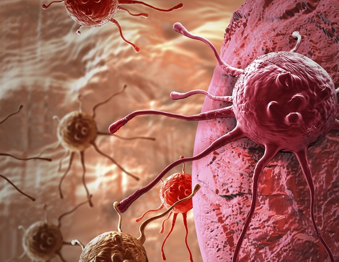 Das Lerner Research Institute der Cleveland Clinic erhielt vom National Cancer Institute, einem Teil der National Institutes of Health, einen fünfjährigen Zuschuss in Höhe von 12 Millionen US-Dollar, um zu definieren, wie Zytokine – Proteine, die während der Immunantwort produziert werden – Entzündungen regulieren und mit Zellen und Molekülen interagieren, die Tumore umgeben. Die Abgabe von Zytokinen in der Immuntherapie kann eine Immunantwort signalisieren, die Krebszellen abtötet, aber die daraus resultierende Entzündung kann auch eine Umgebung schaffen, die die Mutation von Zellen und das Wachstum von Tumoren fördert. Das Sammeln detaillierter Informationen darüber, wie Zytokine bei bestimmten Krebsarten funktionieren, kann …