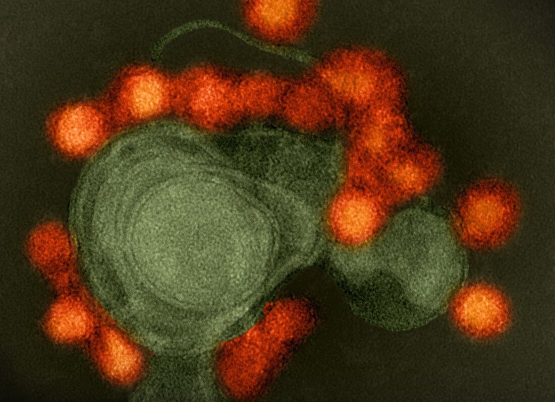 Die Infektion mit dem Zika-Virus (ZIKV) ist eine potenziell teratogene Krankheit, die dazu führt, dass bis zu einem von sieben Säuglingen, die von infizierten Müttern geboren werden, neurologische Entwicklungsdefizite erleiden. Eine neue Studie in der Zeitschrift veröffentlicht Zelle zeigt, dass einige Mütter einer Verletzung ihrer Babys entgehen, weil sie einen hochwirksamen neutralisierenden Antikörper entwickeln. Dies zeigt die Bedeutung solcher Antikörper beim Schutz des Fötus vor dem Zika-Virus und stellt gleichzeitig einen möglicherweise nützlichen Antikörper zur Verhinderung einer fötalen Infektion dar. Lernen: Ein in der Schwangerschaft hervorgerufenes Zika-Virus-spezifisches IgM zeigt eine ultrapotente Neutralisierung. Bildnachweis: NIAID Einführung ZIKV trat in Amerika auf …