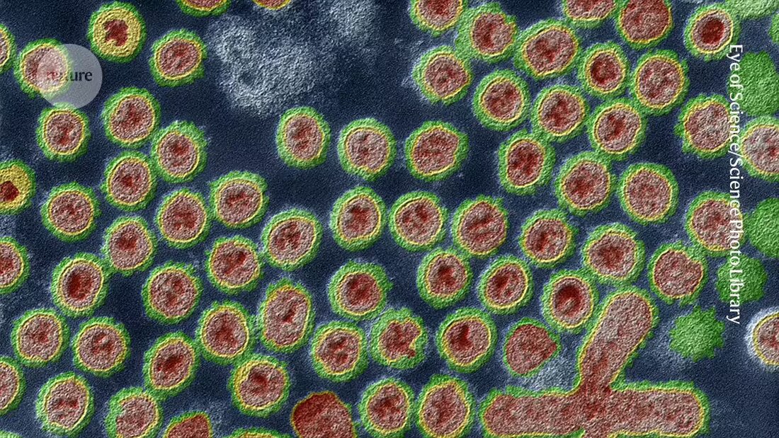 Craft a short meta-description for an article about "Is bird flu spreading among people? Data gaps leave researchers in the dark", in German. The article contains the following content: "<div class="c-article-body main-content">
                    <figure class="figure">
 <picture class="embed intensity--high">
  <source type="image/webp" srcset="https://media.nature.com/lw767/magazine-assets/d41586-024-03089-8/d41586-024-03089-8_27692490.jpg?as=webp 767w, https://media.nature.com/lw319/magazine-assets/d41586-024-03089-8/d41586-024-03089-8_27692490.jpg?as=webp 319w" sizes="(max-width: 319px) 319px, (min-width: 1023px) 100vw,  767px">
  <img class="figure__image" alt="Avian influenza virus particles as a coloured transmission electron micrograph." loading="lazy" src="https://media.nature.com/lw767/magazine-assets/d41586-024-03089-8/d41586-024-03089-8_27692490.jpg">
  <figcaption>
   
  </figcaption>
 </source></picture>
</figure><p>All eyes are on Missouri.</p><p>Researchers are anxiously awaiting data from the midwestern state about a mysterious bird flu infection in a person who had no known contact with potential animal carriers of the disease. The data could reveal whether <a href="https://www.nature.com/articles/d41586-024-01256-5" data-track="click" data-label="https://www.nature.com/articles/d41586-024-01256-5" data-track-category="body text link">the ongoing US bird flu outbreak in dairy cattle</a> has reached a dreaded turning point: the emergence of a virus capable of spreading from human to human.</p><p>
 </p><p>Thus far, data from the mysterious infection are few and far between: small snippets of the H5N1 virus’s genome sequence and an incomplete infection timeline. Ratcheting up concerns is the fact that no Missouri dairy farms have reported a <a href="https://www.nature.com/collections/jicdgbcgda" data-track="click" data-label="https://www.nature.com/collections/jicdgbcgda" data-track-category="body text link">bird </a><a href="https://www.nature.com/collections/jicdgbcgda" data-track="click" data-label="https://www.nature.com/collections/jicdgbcgda" data-track-category="body text link">flu</a> outbreak; this might be because there really are no infections, or because the state does not require farmers to test their cows for the virus.</p><p>“The fear is that the virus is spreading within the community at low levels, and this is the first time that we’re detecting it,” says Scott Hensley, a viral immunologist at the University of Pennsylvania Perelman School of Medicine in Philadelphia. “There’s no data to suggest that to be the case, but that’s the fear.”</p><h2>A mystery case</h2><p>On 6 September, Missouri public-health officials and the US Centers for Disease Control and Prevention (CDC) announced that an adult in the state had developed symptoms including chest pain, nausea, vomiting and diarrhea, and was hospitalized owing to other medical conditions. That person did not become severely ill and has recovered from the infection. Tests revealed it to be H5N1 influenza, often referred to as bird flu.</p><p>Since March, <a href="https://www.nature.com/articles/d41586-024-01036-1" data-track="click" data-label="https://www.nature.com/articles/d41586-024-01036-1" data-track-category="body text link">when the H5N1 virus was first detected in US dairy cattle</a>, there have been more than a dozen cases of human infection that were traced back to contact with infected animals, including cows and birds. The Missouri case stands out because investigators found no such link and no tie to unprocessed food products, <a href="https://www.nature.com/articles/d41586-024-01624-1" data-track="click" data-label="https://www.nature.com/articles/d41586-024-01624-1" data-track-category="body text link">such as raw milk</a>, from potentially infected livestock.</p><p>
 </p><p>This raised the possibility that the virus might have evolved to not only infect humans, but also to spread between people. If so, this increases the risk of it sweeping through human populations, potentially triggering a dangerous outbreak.</p><p>But that’s not the only possibility, cautions Jürgen Richt, a veterinary virologist at Kansas State University in Manhattan. “It’s a mystery case,” he says. “So you have to throw your net a little wider. Maybe they cleaned out a bird feeder in the household. Did they go to a state fair? What kind of food did they consume?”</p><p>More concerns were raised about the Missouri case on 13 September, when the CDC announced that two people who had close contact with the hospitalized person had also become ill around the same time. One of them was not tested for flu; the other tested negative.</p><p>That test result is encouraging but not definitive, says Hensley, because the sample could have been collected when the individual’s viral levels were too low for detection — after they started to recover, for instance. A key next step will be to test all three people for antibodies against the strain of H5N1 bird flu that has been infecting cattle. Such antibodies, particularly in the two contacts, would be definitive evidence of past infection.</p><h2>Genomic sleuthing</h2><p>While researchers await the antibody results, they are combing through patchy genome-sequence data from virus samples from the hospitalized person. This could yield any signs that the virus might have adapted to human hosts. The search is a challenge, however: the samples contained very low levels of viral RNA — so little that some researchers have shied away from analysing the sequences altogether.</p><p>
 </p><p>“What I would want to see is higher quality,” says Ryan Langlois, a viral immunologist at the University of Minnesota Medical School in Minneapolis. “I am very leery about interpreting anything from partial sequences.”</p><p>But for Hensley, one feature of the sequence fragments immediately leapt out: a single change in the string of amino acids that form a flu protein called hemagglutinin (the ‘H’ in H5N1). That protein sits on the surface of influenza viruses, where it helps the viruses bind to and infect host cells. It is also a target of flu vaccines.</p><p>The change that Hensley found creates a site to which a large sugar molecule can bind. That sugar, he says, could then act as an umbrella, shielding the swath of hemagglutinin beneath it. It is a change that his laboratory has studied in other flu strains, and it could affect how the virus binds to host cells — as well as whether vaccines being developed against the H5N1 virus found in cattle can recognize and perform well against the virus detected in Missouri.</p><h2>Surveillance gaps</h2><p>Even if the sequences were available, researchers know little about which genetic changes might allow bird flu viruses to better infect humans or to become airborne, says virologist Yoshihiro Kawaoka at the University of Wisconsin–Madison. Previous studies<sup><a href="#ref-CR1" data-track="click" data-action="anchor-link" data-track-label="go to reference" data-track-category="references">1</a></sup><sup>,</sup><sup><a href="#ref-CR2" data-track="click" data-action="anchor-link" data-track-label="go to reference" data-track-category="references">2</a></sup> had suggested that changes to a gene encoding a protein responsible for copying the viral genome could be crucial for allowing the virus to replicate in mammalian cells. But researchers were unable to sequence that gene from the isolate from Missouri.</p><p>Meanwhile, the CDC has issued contracts to five companies in the United States to provide testing services for H5N1 and other emerging pathogens. Testing of cattle also needs to be improved so that public-health officials will know which regions of the country to surveil for infections in humans, says Seema Lakdawala, a virologist at Emory University in Atlanta, Georgia. In the United States, most testing of cattle is regulated at the state level, but only a handful of states have required routine testing on some dairy farms.</p><p>Public-health workers still don’t have a good handle on how many US herds have cows infected with H5N1, or whether cattle have immunity after contracting bird flu or can become reinfected, she says.</p><p>While researchers wait for more information, Hensley cautions against panic. “This could still be a one-off case and not the sign of something bigger,” he says.</p>
                </div><br><div class="c-article-section__content" id="Bib1-content"><div data-container-section="references"><ol class="c-article-references" data-track-component="outbound reference" data-track-context="references section"><li class="c-article-references__item js-c-reading-companion-references-item" data-counter="1."><p class="c-article-references__text" id="ref-CR1">Imai, M. <i>et al.</i> <i>Nature</i> <b>486</b>, 420-428 (2012).</p><p class="c-article-references__links u-hide-print"><a data-track="click||click_references" rel="nofollow noopener" data-track-label="10.1038/nature10831" data-track-item_id="10.1038/nature10831" data-track-value="article reference" data-track-action="article reference" href="https://doi.org/10.1038%2Fnature10831" aria-label="Article reference 1" data-doi="10.1038/nature10831">Article</a> 
    <a data-track="click||click_references" rel="nofollow noopener" data-track-label="link" data-track-item_id="link" data-track-value="pubmed reference" data-track-action="pubmed reference" href="http://www.ncbi.nlm.nih.gov/entrez/query.fcgi?cmd=Retrieve&db=PubMed&dopt=Abstract&list_uids=22722205" aria-label="PubMed reference 1">PubMed</a> 
    <a data-track="click||click_references" data-track-action="google scholar reference" data-track-value="google scholar reference" data-track-label="link" data-track-item_id="link" rel="nofollow noopener" aria-label="Google Scholar reference 1" href="http://scholar.google.com/scholar_lookup?&title=&journal=Nature&doi=10.1038%2Fnature10831&volume=486&pages=420-428&publication_year=2012&author=Imai%2CM.">
                    Google Scholar</a> 
                </p></li><li class="c-article-references__item js-c-reading-companion-references-item" data-counter="2."><p class="c-article-references__text" id="ref-CR2">Herfst, S. <i>et al.</i> <i>Science</i> <b>336</b>, 1534-1541 (2012).</p><p class="c-article-references__links u-hide-print"><a data-track="click||click_references" rel="nofollow noopener" data-track-label="10.1126/science.1213362" data-track-item_id="10.1126/science.1213362" data-track-value="article reference" data-track-action="article reference" href="https://doi.org/10.1126%2Fscience.1213362" aria-label="Article reference 2" data-doi="10.1126/science.1213362">Article</a> 
    <a data-track="click||click_references" rel="nofollow noopener" data-track-label="link" data-track-item_id="link" data-track-value="pubmed reference" data-track-action="pubmed reference" href="http://www.ncbi.nlm.nih.gov/entrez/query.fcgi?cmd=Retrieve&db=PubMed&dopt=Abstract&list_uids=22723413" aria-label="PubMed reference 2">PubMed</a> 
    <a data-track="click||click_references" data-track-action="google scholar reference" data-track-value="google scholar reference" data-track-label="link" data-track-item_id="link" rel="nofollow noopener" aria-label="Google Scholar reference 2" href="http://scholar.google.com/scholar_lookup?&title=&journal=Science&doi=10.1126%2Fscience.1213362&volume=336&pages=1534-1541&publication_year=2012&author=Herfst%2CS.">
                    Google Scholar</a> 
                </p></li></ol><p class="c-article-references__download u-hide-print"><a data-track="click" data-track-action="download citation references" data-track-label="link" rel="nofollow" href="https://citation-needed.springer.com/v2/references/10.1038/d41586-024-03089-8?format=refman&flavour=references">Download references<svg width="16" height="16" focusable="false" role="img" aria-hidden="true" class="u-icon"><use xmlns:xlink="http://www.w3.org/1999/xlink" xlink:href="#icon-eds-i-download-medium"></use></svg></a></p></div></div>". Don't add the title at the beginning of the created content. Write it as if you want to inform the readers about who, what, when, where, why and how. Dont exceed 120 characters. Style: Maintain a professional level of formality suitable for a newspaper, but avoid overly complex language to ensure the content is accessible to a wide audience. Include keywords related to the news event and phrases likely to be used by readers searching for information on the topic. Tone: While keeping the tone professional, use engaging language to capture the reader's interest without sensationalizing. Reply in plain Text without putting the meta-description into any quotes. Excerpt: