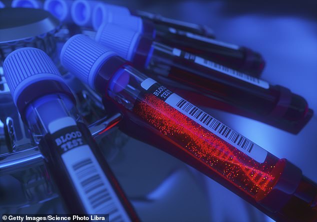 Europäische Gesundheitsbehörden haben grünes Licht für ein genetisches Medikament gegeben, das als „fast heilbar“ für die tödliche Bluterkrankheit Hämophilie gilt.  (Dateibild)