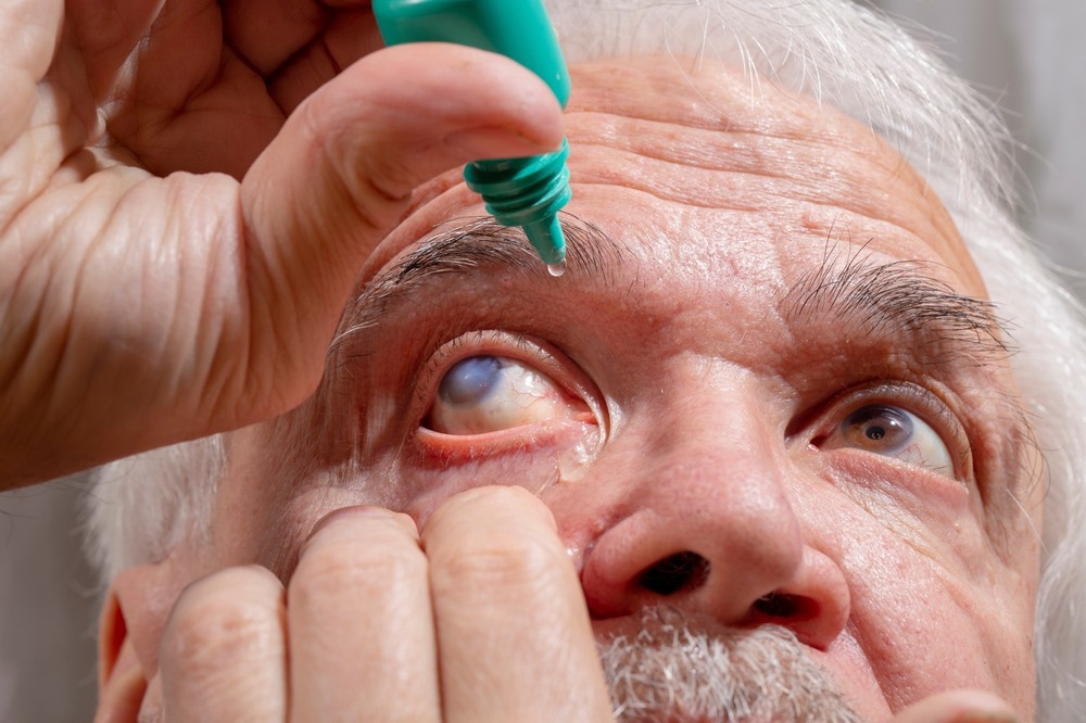Study: Association of sleep behavior and pattern with the risk of glaucoma: a prospective cohort study in the UK Biobank. Image Credit: SERGEI PRIMAKOV / Shutterstock.com