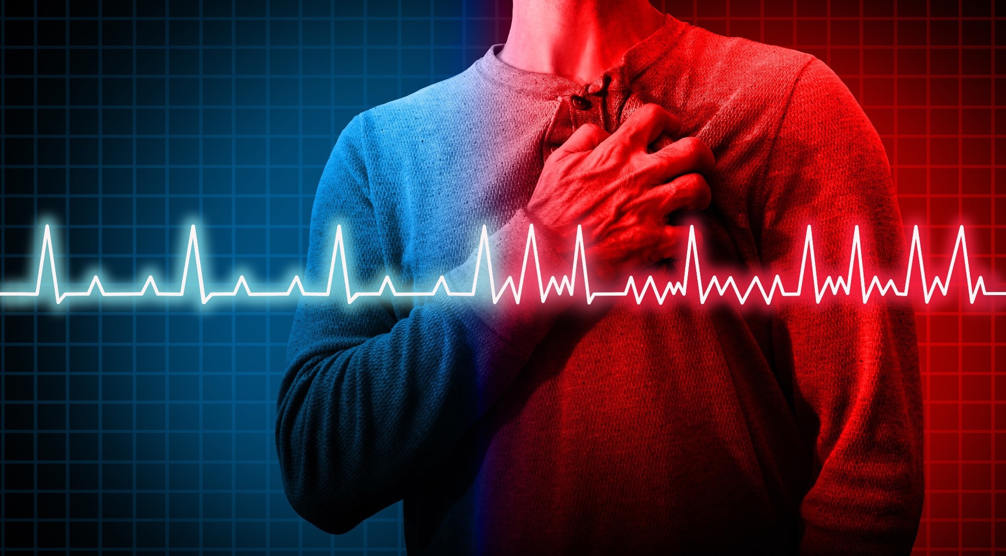Study: Cannabis, cocaine, methamphetamine, and opiates increase the risk of incident atrial fibrillation. Image Credit: Lightspring / Shutterstock