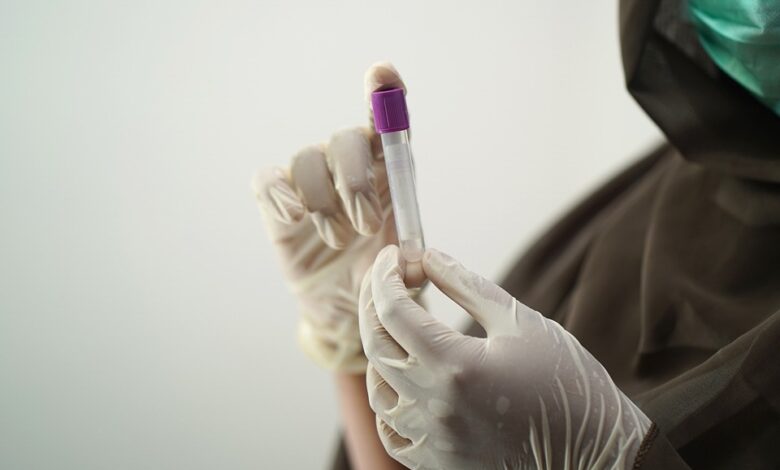 Nicht-invasiver Bluttest zeigt eine Sensitivität von 83 % bei der Erkennung von Darmkrebs und gibt Hoffnung auf eine frühzeitige Diagnose