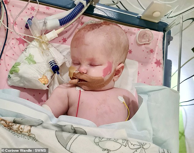 Frau Wardle brachte Molly Mai letzten Monat wegen ihres geschwollenen Kopfes in die Notaufnahme und wurde sofort in das Alder Hey Children's Hospital überwiesen, wo die Ärzte einen Tumor im Gehirn des Dreimonatigen entdeckten