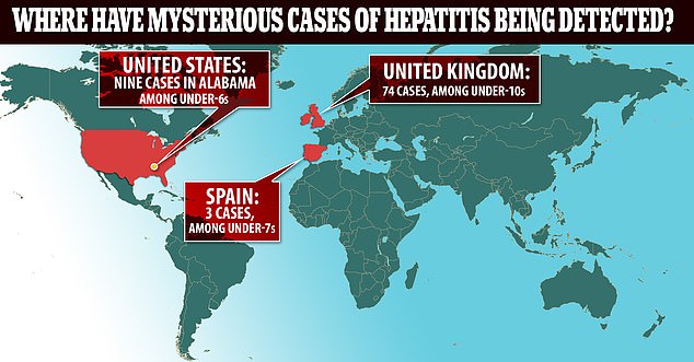 Das Obige zeigt Länder, die Fälle von Hepatitis melden, die möglicherweise durch ein Virus verursacht werden, das eine gewöhnliche Erkältung auslöst.  In den USA gibt es Fälle in Alabama (dargestellt durch den gelben Punkt).  Im Vereinigten Königreich wurden sie in England und Gebieten Schottlands gemeldet.  In Spanien wurden sie in der Hauptstadt Madrid und in der Region Aragon entdeckt