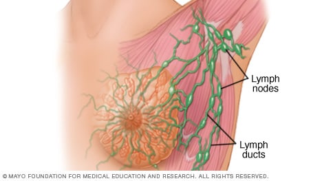 Lymphknoten und Lymphgänge in der Brust