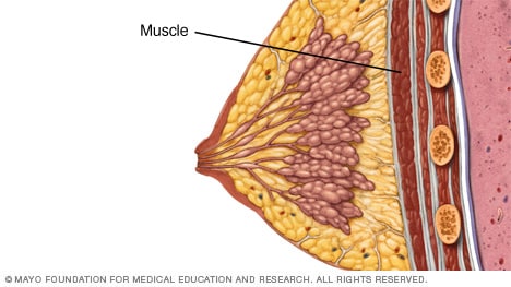 Muskel unter der Brust