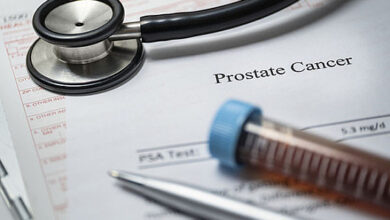 Prostatakrebs: Die Strahlentherapie erhöht das Risiko für zukünftige Krebserkrankungen
