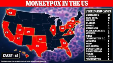 Amerika verzeichnete am vergangenen Wochenende 16 Affenpockenfälle, was einer Gesamtzahl von 65 entspricht, da der Ausbruch den siebzehnten Bundesstaat Ohio trifft