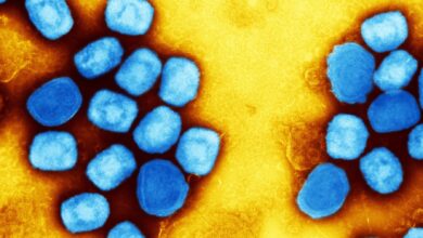 Study: Vaccinia-Virus-Based Vaccines Are Expected to Elicit Highly Cross-Reactive Immunity to the 2022 Monkeypox Virus. Image Credit: NIAID