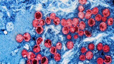 Study: Genome characterization of monkeypox cases detected in India: Identification of three sub clusters among A.2 lineage. Image Credit: NIAID