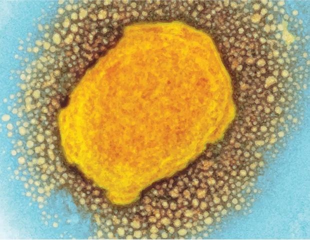 Wissenschaftler weisen das Affenpockenvirus während einer akuten Infektion in den Hoden von Makaken nach