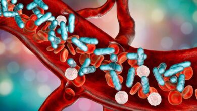 Study: Integrated host-microbe plasma metagenomics for sepsis diagnosis in a prospective cohort of critically ill adults. Image Credit: Kateryna Kon/Shutterstock