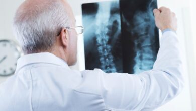 Die Kombinationsbehandlung verlangsamt die röntgenologische Wirbelsäulenprogression bei röntgenologischen axSpA-Patienten nicht
