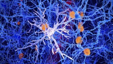 Study: Emerging roles of innate and adaptive immunity in Alzheimer’s disease. Image Credit: Juan Gaertner/Shutterstock