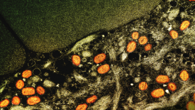 Medical News & Perspectives - Reports of Asymptomatic Monkeypox Suggest That, at the Very Least, Some Infections Go Unnoticed. Image Credit: NIAID