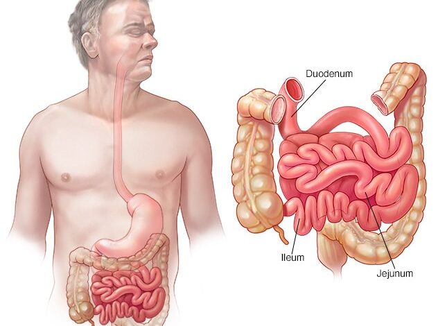 Dünndarm – Zwölffingerdarm, Jejunum und Ileum