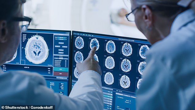 Wissenschaftler haben einen Algorithmus entwickelt, der den Zustand mit einer Genauigkeit von bis zu 98 Prozent diagnostizieren kann.  Es verwendet die Standard-MRT-Technologie, die in den meisten Krankenhäusern zu finden ist, und liefert ein Ergebnis in 12 Stunden (Archivbild)