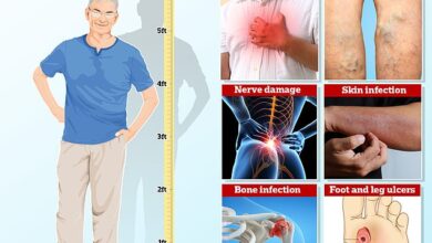 US-Forscher haben aus einer Studie mit 250.000 Erwachsenen mit einer durchschnittlichen Körpergröße von 5 Fuß 9 Zoll herausgefunden, dass die Körpergröße mit Gesundheitszuständen in Verbindung gebracht werden könnte