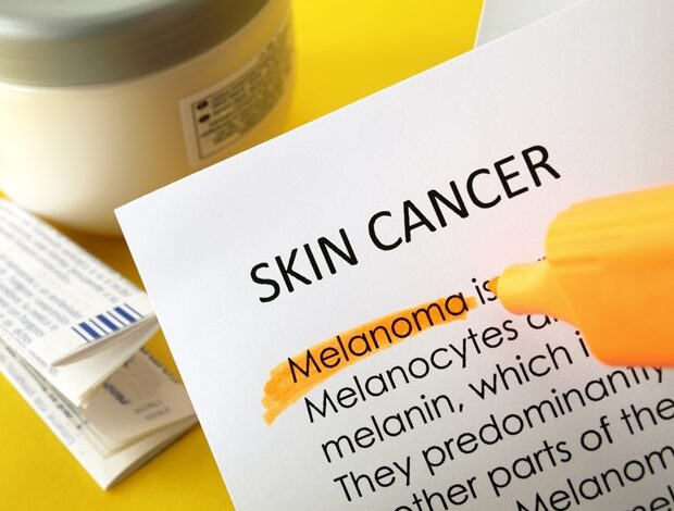 Hautkrebs ist unabhängig vom Hautton ein Risiko.  Aber es kann bei Menschen mit dunkler Haut übersehen werden.