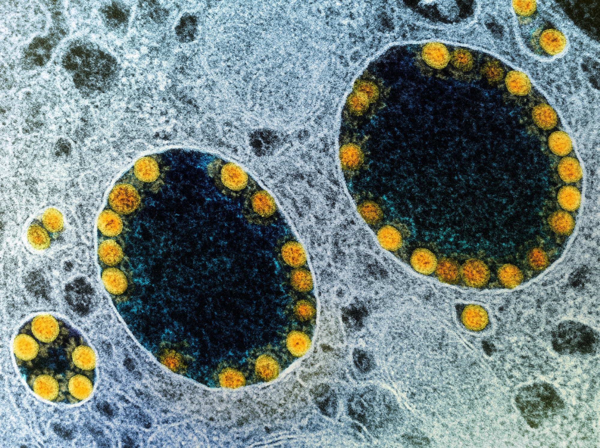 Studie: Vom Menschen induzierte pluripotente Speicheldrüsenorganoide aus Stammzellen modellieren die SARS-CoV-2-Infektion und -Replikation. Bildnachweis: NIAID