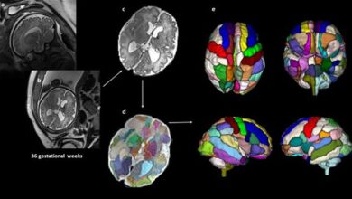 Forscher des Boston Children's Hospital untersuchten Ultraschalluntersuchungen von 40 Babys vor ihrer Geburt.  Im Bild: Ultraschalluntersuchung des Gehirns des ungeborenen Babys (a und b);  ein verarbeitetes Bild des Scans, um es von anderen Körperteilen des Babys und der Mutter zu entfernen (c);  der durch Farben segmentierte Gehirnscan, um die verschiedenen Teile zu zeigen (d);  3D-Versionen des Gehirns basierend auf den Scanergebnissen