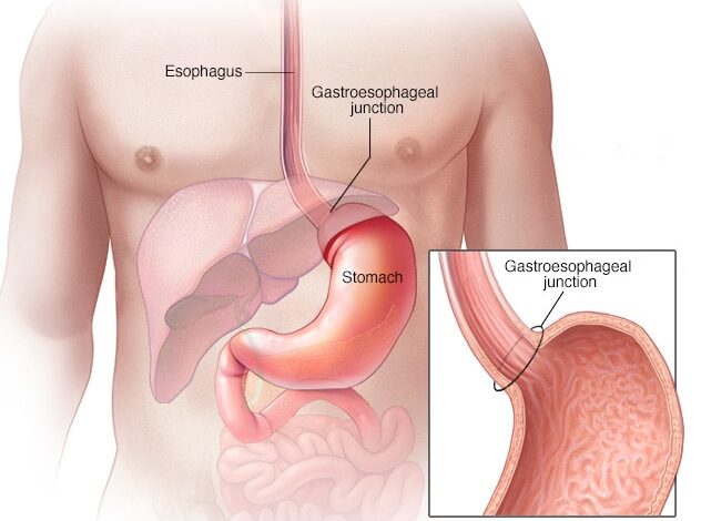 Speiseröhre, gastroösophagealer Übergang und Magen