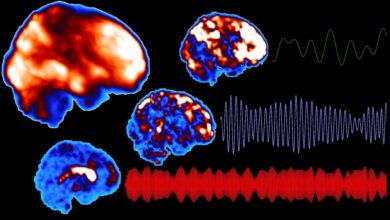 New discovery increases understanding of the effects of narcolepsy on the brain