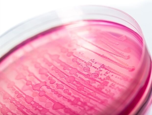 Neues Update zur CDC-Untersuchung des Multistate-Ausbruchs einer E. coli O157-Infektion