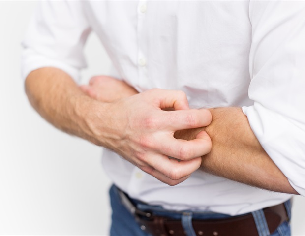 Praktische Tipps zur Behandlung von Neurodermitis bei Babys