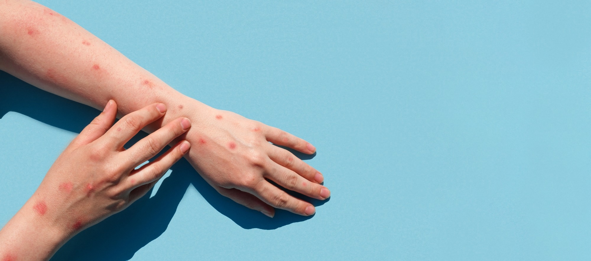 Strukturanalyse des Affenpockenvirus als Leitfaden für die Entwicklung umfassender antiviraler Wirkstoffe