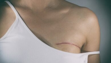 Study: Eliminating breast surgery for invasive breast cancer in exceptional responders to neoadjuvant systemic therapy: a multicentre, single-arm, phase 2 trial. Image Credit: Pradit.Ph / Shutterstock.com