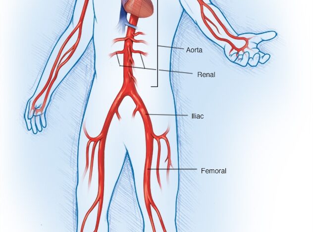 Große Arterien