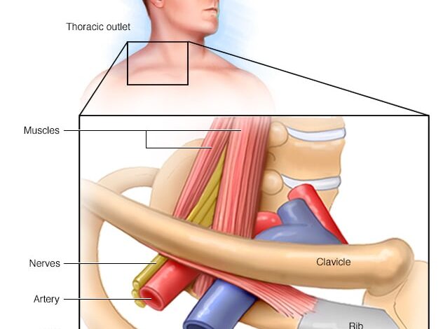 Thoraxauslass