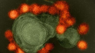 Study: A Zika virus-specific IgM elicited in pregnancy exhibits ultrapotent neutralization. Image Credit: NIAID