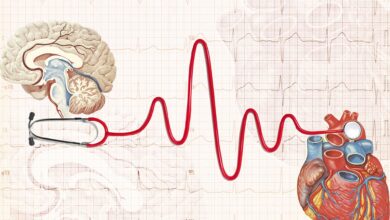 Warum die Überwachung Ihrer Herzgesundheit nach einem Schlaganfall wichtig ist