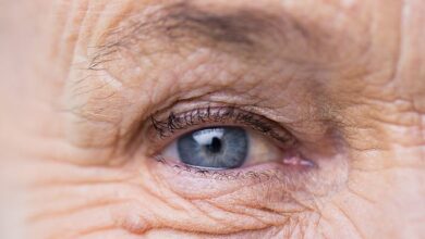Es gibt verschiedene Ursachen für ein tränendes Auge, medizinisch bekannt als Epiphora, aber das Alter gehört nicht dazu